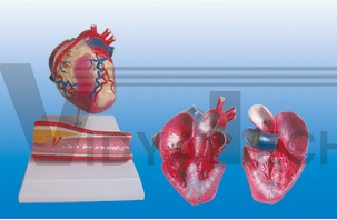 The model of myocardium hypertrophy